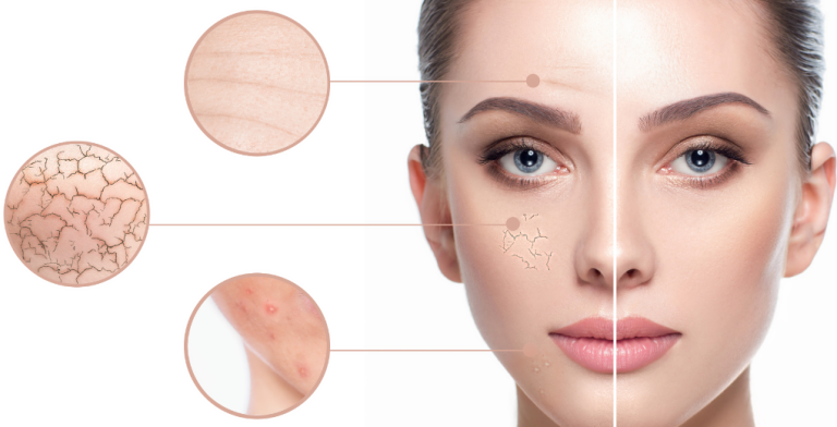 Rejuvenecimiento facial